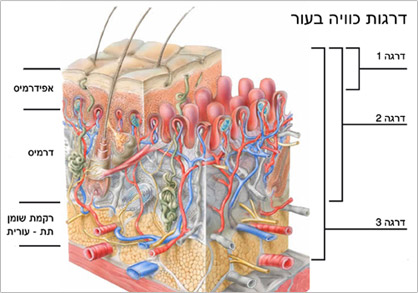 ביגוד לחץ
