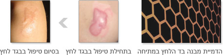 ביגוד לחץ